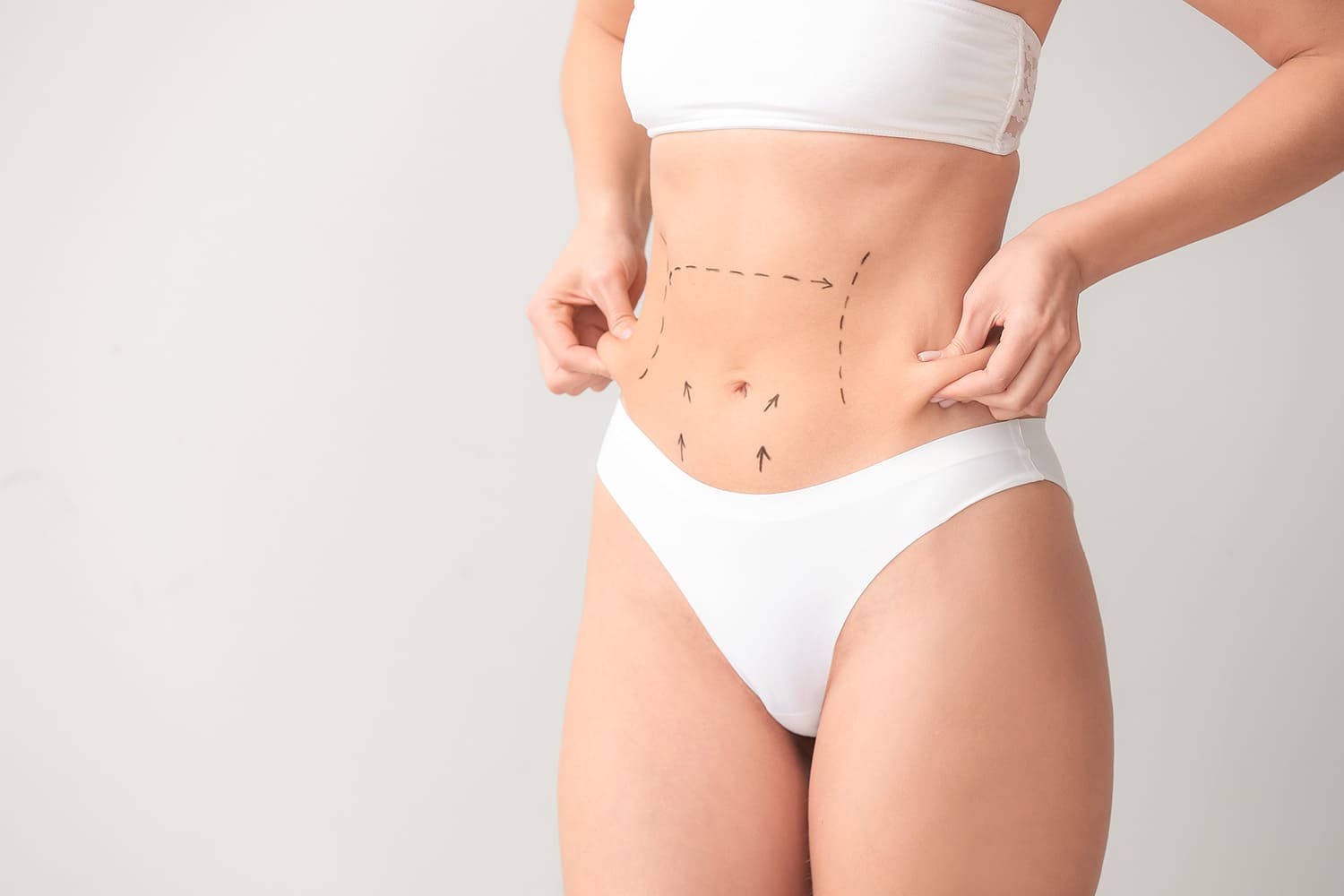 Abdominoplastie à Lyon • Chirurgie du Ventre